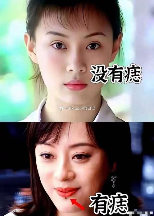 新澳2025今晚特马开奖结果和孙俪唇下痣没了与孙俪嘴唇的痣
